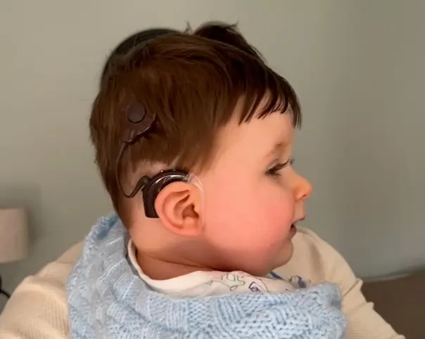 Koxlear İmplant istifadəçisini necə dəstəkləyə bilərsiniz?